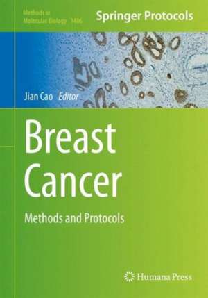 Breast Cancer: Methods and Protocols de Jian Cao