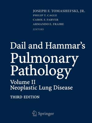 Dail and Hammar's Pulmonary Pathology: Volume II: Neoplastic Lung Disease de Joseph F. Tomashefski