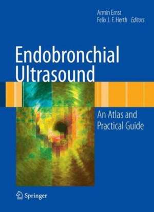 Endobronchial Ultrasound: An Atlas and Practical Guide de Armin Ernst