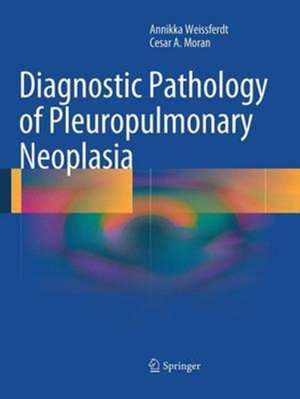 Diagnostic Pathology of Pleuropulmonary Neoplasia de Annikka Weissferdt