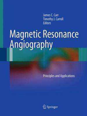 Magnetic Resonance Angiography: Principles and Applications de James C. Carr