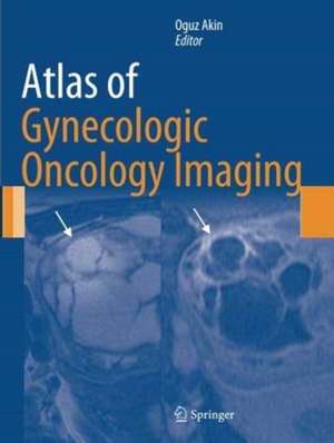 Atlas of Gynecologic Oncology Imaging de Oguz Akin