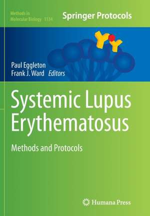 Systemic Lupus Erythematosus: Methods and Protocols de Paul Eggleton