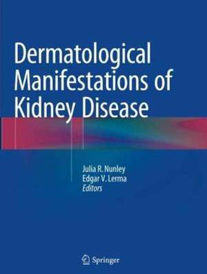 Dermatological Manifestations of Kidney Disease de Julia R. Nunley