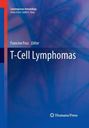 T-Cell Lymphomas de Francine Foss