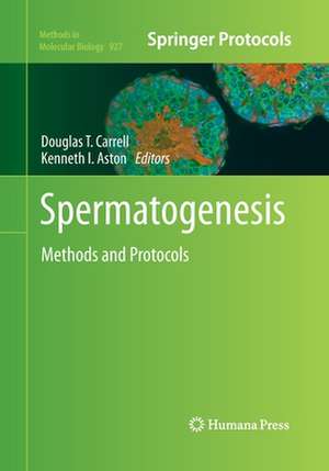 Spermatogenesis: Methods and Protocols de Lori Barnard