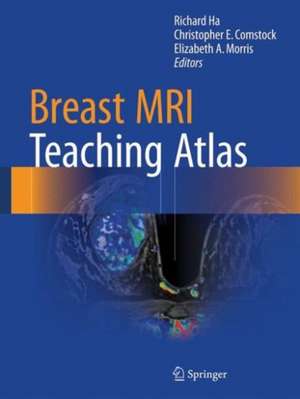 Breast MRI Teaching Atlas de Richard Ha