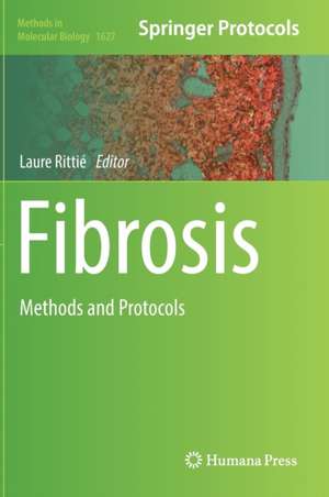 Fibrosis: Methods and Protocols de Laure Rittié