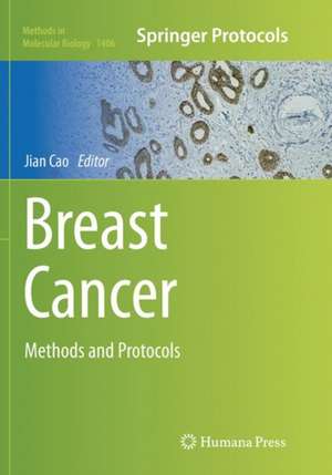 Breast Cancer: Methods and Protocols de Jian Cao