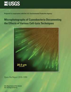 Microphotographs of Cyanobacteria Documenting the Effects of Various Cell-Lysis Techniques de U. S. Department of the Interior