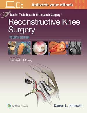 Master Techniques in Orthopaedic Surgery: Reconstructive Knee Surgery de Dr. Darren L. Johnson MD