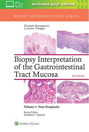 Biopsy Interpretation of the Gastrointestinal Tract Mucosa: Volume 1: Non-Neoplastic de Elizabeth A. Montgomery MD