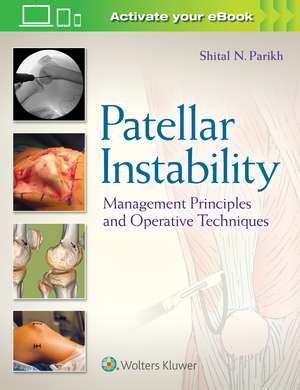 Patellar Instability: Management Principles and Operative Techniques de Dr. Shital N Parikh MD