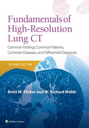 Fundamentals of High-Resolution Lung CT: Common Findings, Common Patterns, Common Diseases and Differential Diagnosis de Brett M Elicker MD