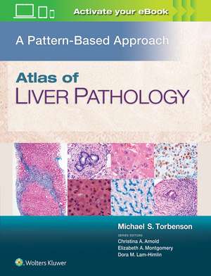 Atlas of Liver Pathology: A Pattern-Based Approach de Michael Torbenson MD