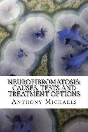 Neurofibromatosis de Anthony S. Michaels Ma