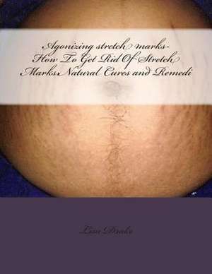 Agonizing Stretch Marks-How to Get Rid of Stretch Marks de Lisa Drake