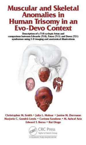 Muscular and Skeletal Anomalies in Human Trisomy in an Evo-Devo Context: Description of a T18 Cyclopic Fetus and Comparison Between Edwards (T18), Patau (T13) and Down (T21) Syndromes Using 3-D Imaging and Anatomical Illustrations de Rui Diogo