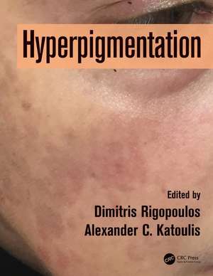 Hyperpigmentation de Dimitris Rigopoulos