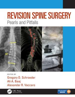 Revision Spine Surgery: Pearls and Pitfalls de Alexander R. Vaccaro