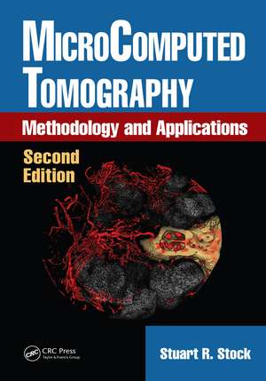 MicroComputed Tomography: Methodology and Applications, Second Edition de Stuart R. Stock