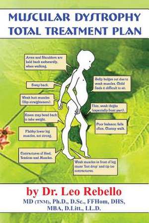 Muscular Dystrophy de Dr Leo Rebello