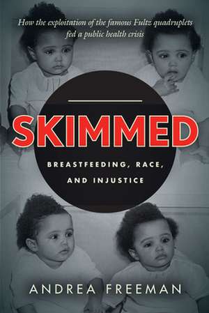 Skimmed – Breastfeeding, Race, and Injustice de Andrea Freeman