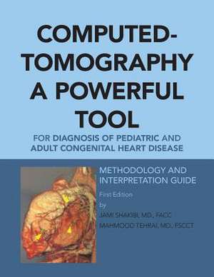 Computed-Tomography a Powerful Tool for Diagnosis of Pediatric and Adult Congenital Heart Disease: Methodology and Interpretation Guide de Facc Shakibi