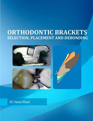 Orthodontic Brackets de Dr Haris Khan