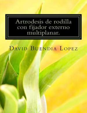 Artrodesis de Rodilla Con Fijador Externo Multiplanar. de D. David Buendia Lopez