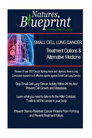 Small Cell Lung Cancer - Treatment Options and Alternative Medicine de Christian Vazquez