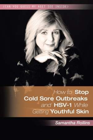 How to Stop Coldsore Outbreaks and Hsv-1 While Getting Youthful Skin de Samantha Rollins