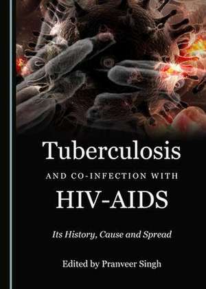 Tuberculosis and Co-infection with HIV-AIDS