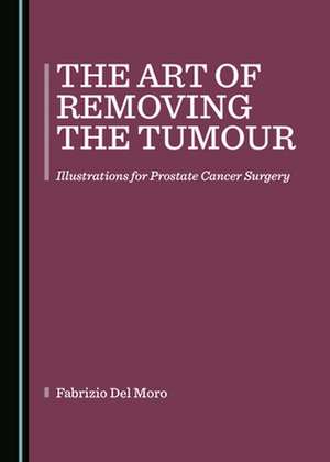 Art of Removing the Tumour de Fabrizio Del Moro