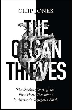 The Organ Thieves: The Shocking Story of the First Heart Transplant in America's Segregated South de Chip Jones