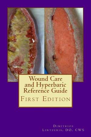 Wound Care and Hyperbaric Reference Guide de Dimitrios P. Lintzeris Do