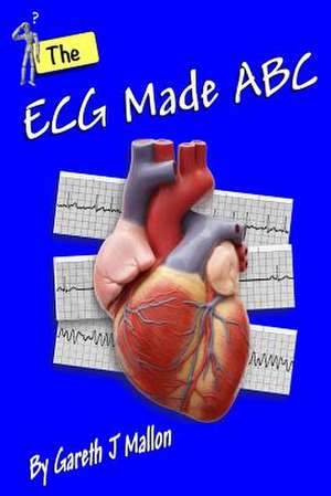 The ECG Made ABC de Gareth J. Mallon