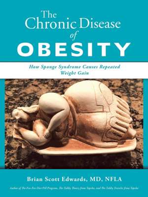 The Chronic Disease of Obesity de Edwards, Brian Scott