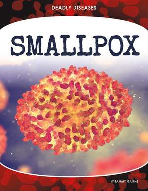 Smallpox de Tammy Gagne