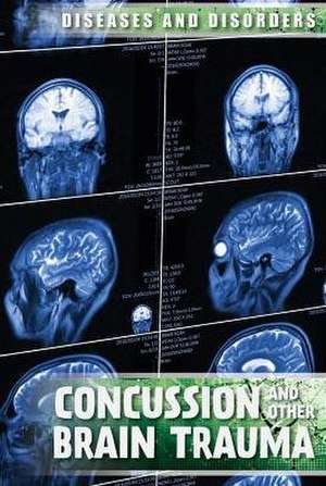 Concussions and Other Brain Trauma de Ryan Nagelhout