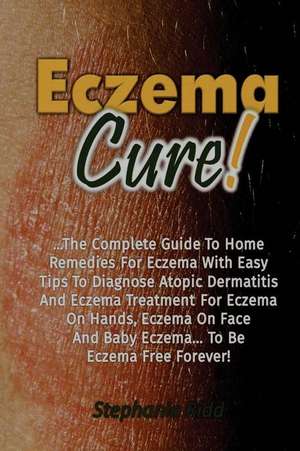 Eczema Cure! de Stephanie Ridd