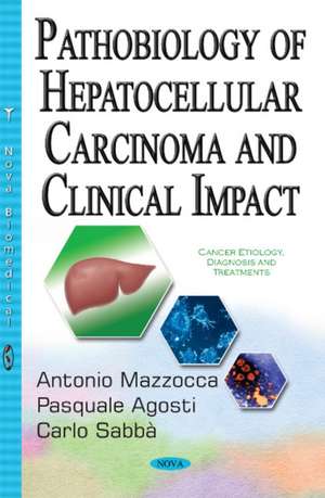 Pathobiology of Hepatocellular Carcinoma & Clinical Impact de Antonio Mazzocca