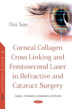 Corneal Collagen Cross-Linking and Femtosecond Laser in Refractive and Cataract Surgery de Hui Sun