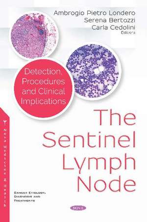 The Sentinel Lymph Node: Detection, Procedures and Clinical Implications de Ambrogio Pietro Londero