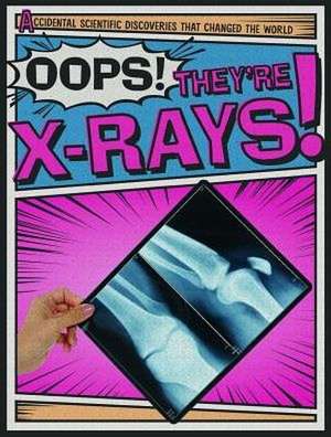 Oops! They're X-Rays! de Nick Wojtan