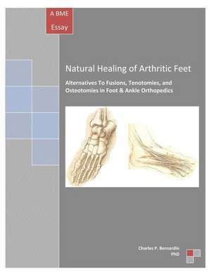 Natural Healing of Arthritic Feet de Bernardin Phd, Charles P.