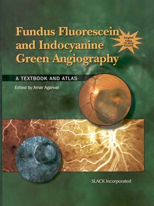 Fundus Fluorescein and Indocyanine Green Angiography: A Textbook and Atlas de Amar Agarwal