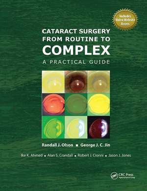 Cataract Surgery from Routine to Complex: A Practical Guide de Randall Olson