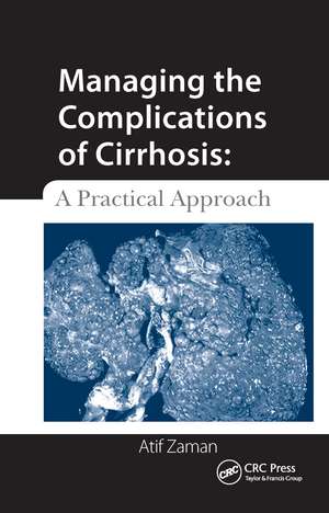 Managing the Complications of Cirrhosis: A Practical Approach de Atif Zaman