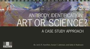 Antibody Identification: Art or Science? a Case Study Approach de Aabb